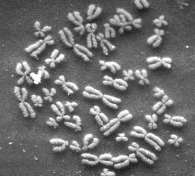 Chromosomes