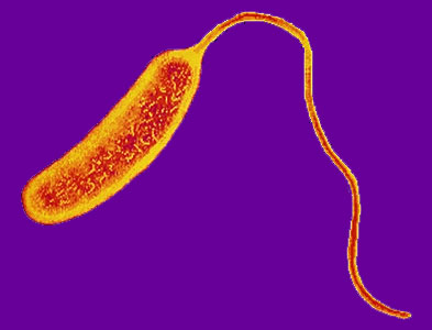 Cholera