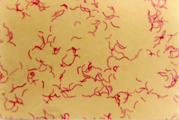 Spirilla
