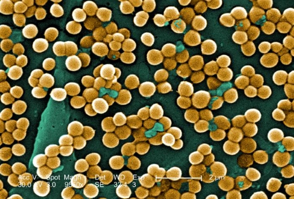 Staphylococcus