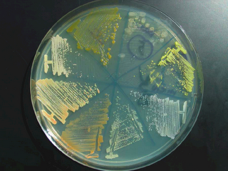 Agar plate