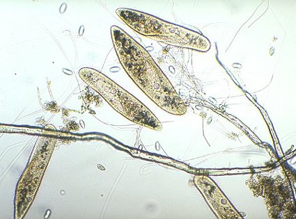 Ciliates