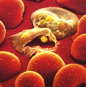 Malaria infection