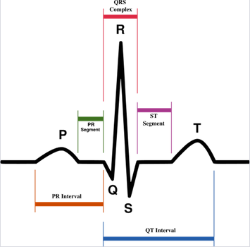Parts of an ECG