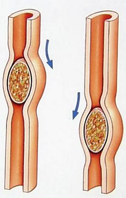 Peristalsis
