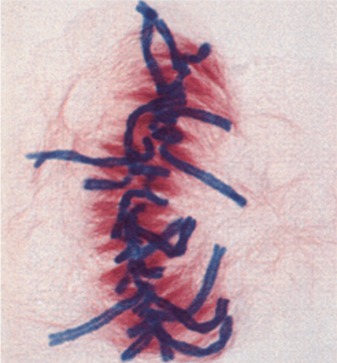 Metaphase