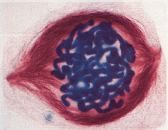 Prophase