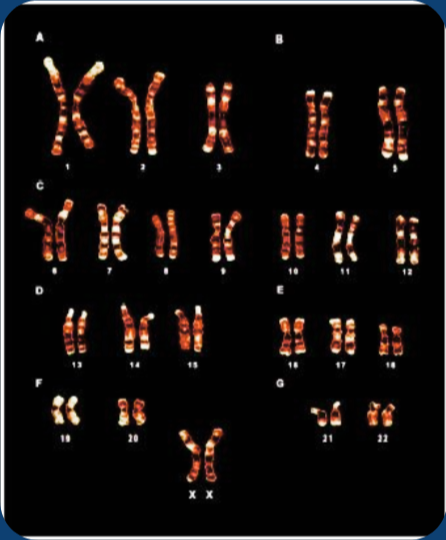 Chromosomes