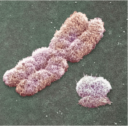 X and Y chromosomes